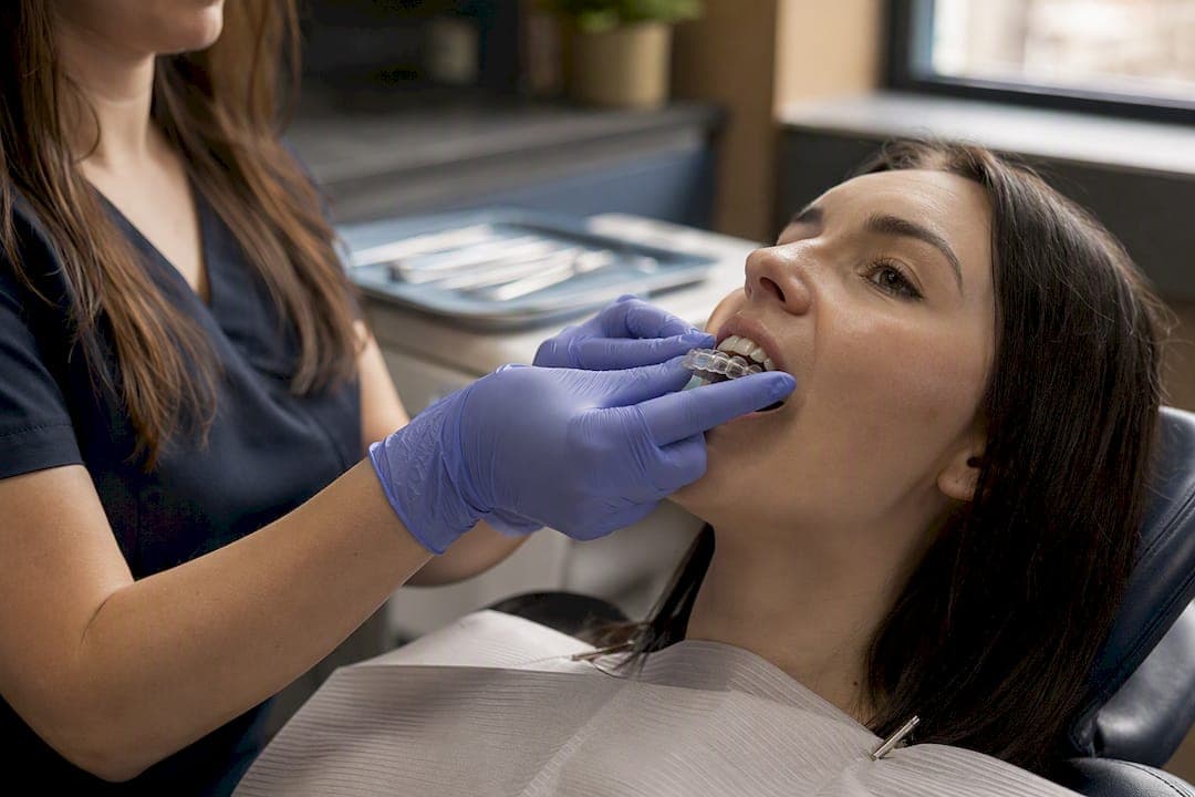 Invisalign Refinements: Why You Might Need More Aligners