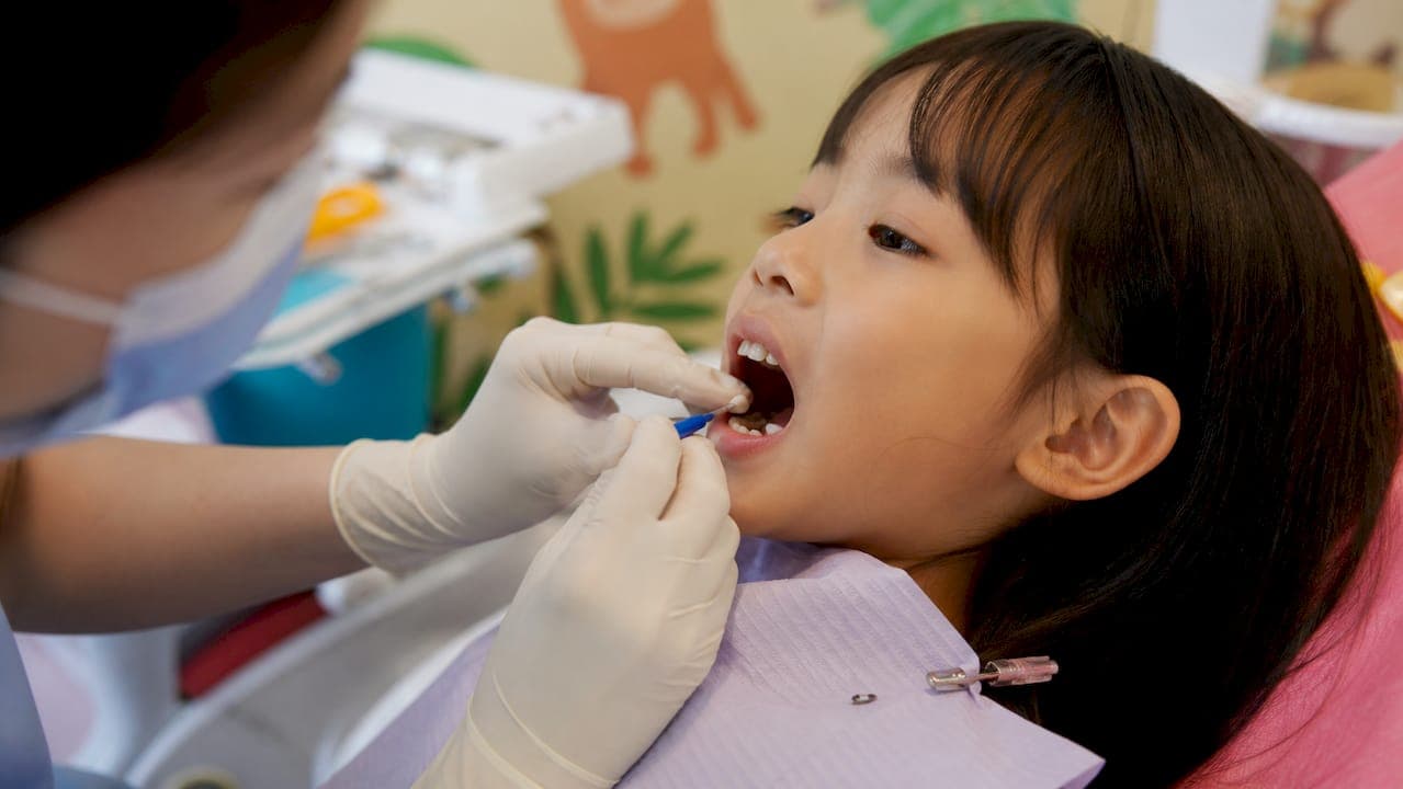 Stop Cavities 65–81%: Silver Diamine Fluoride for Parents